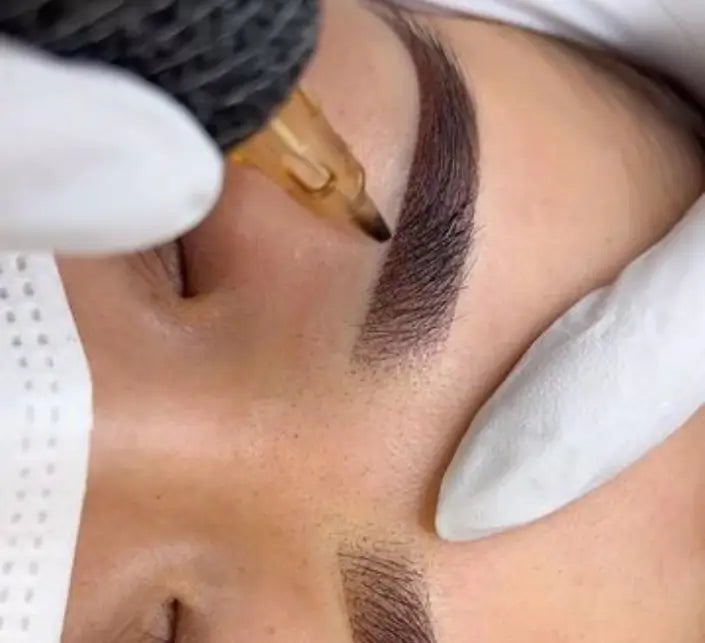 Peeling Chimic Buzău – Tratament Profesional pentru Ten Uniform